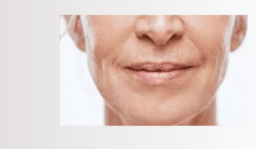 Mis consejos para prevenir y tratar las arrugas y líneas de expresión