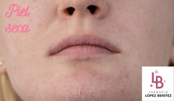 ¿Piel seca?¿Tirantez? Te doy todos los consejos para que le digas adiós.