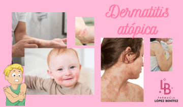 Dermatitis atópica: todo para evitar sus  molestos síntomas