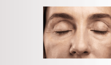 Hidratación de la piel: indispensable en la prevención del envejecimiento