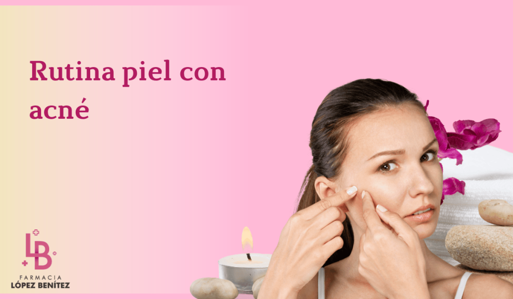 Rutina facial piel con acné