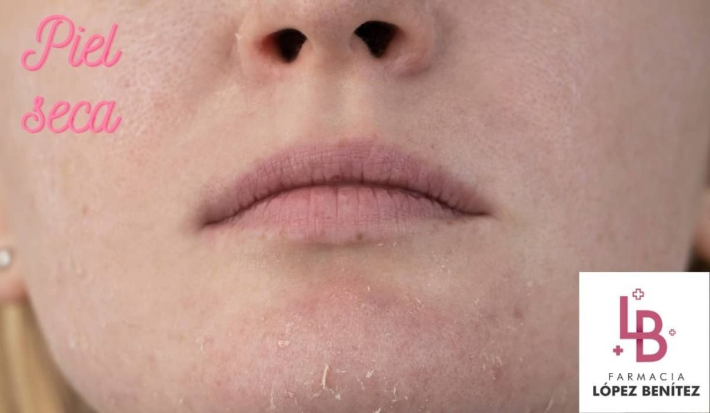 piel seca