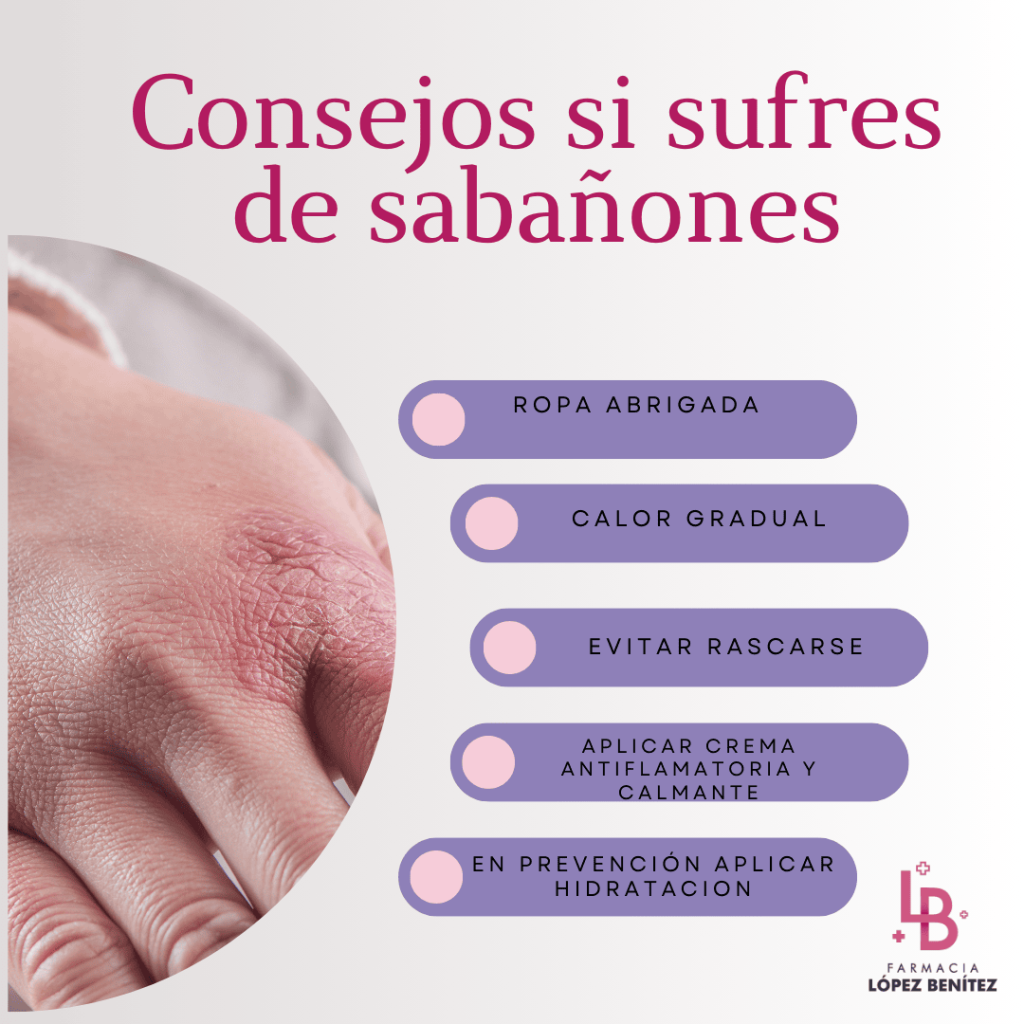 consejos si sufres sabañones