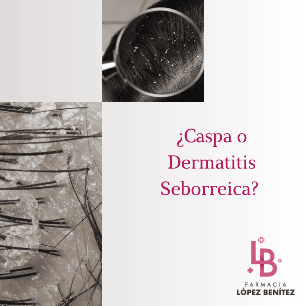 eczema cuero cabelludo