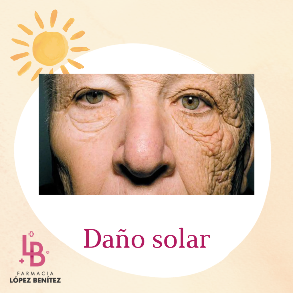 daño solar