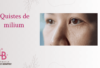 quistes milium
