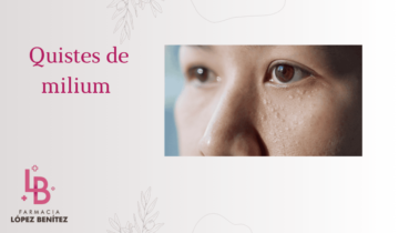 Quistes de Milium: Qué son y Cómo tratar éstas protuberancias blancas