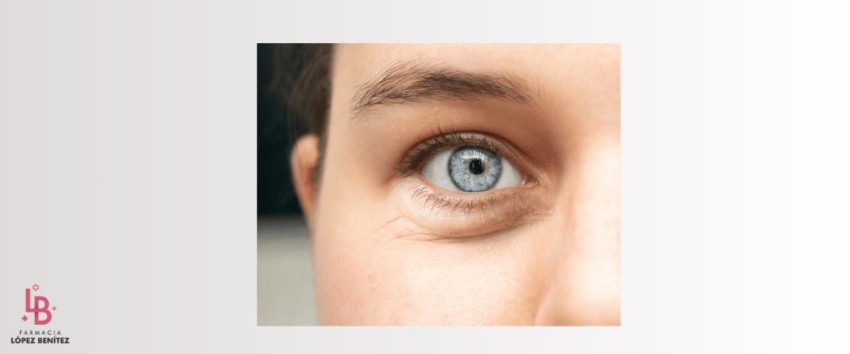 bolsas y ojeras portada